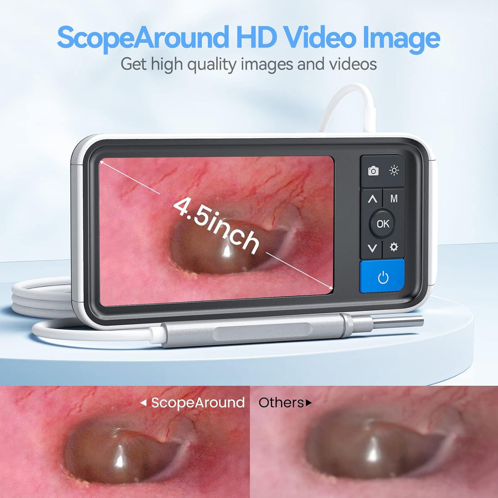 Ear Wax Removal Camera with 4.5 IPS Screen, 1920x1080 FHD Smart Visual Ear Cleaner Tool Kit, Otoscope with Light B96093